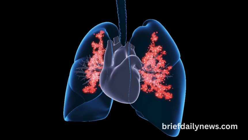 Scientists Discover Unexpected Link Between Diet And Lung Cancer Risk